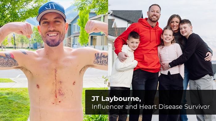 JT Laybourne showing his scar and smiling with his family