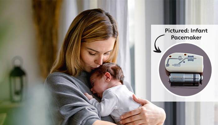 Mother and baby with Pacemaker device
