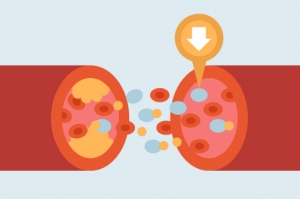 Cholesterol Combination