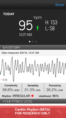 A screenshot of the Cardiio Rhythm app. (Courtesy of Ming-Zher Poh)