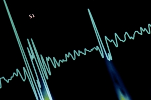 Graphic showing electrocardiogram rhythm
