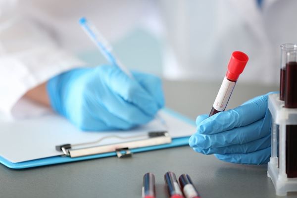 person wearing rubber gloves writing on a pad while holding vial of blood