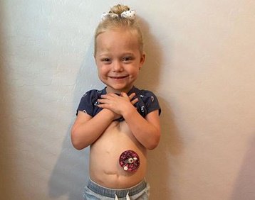 Little girl showing her belly