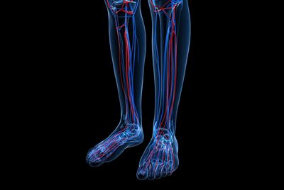 illustration of VTE