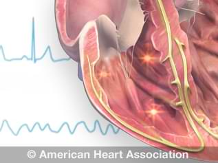 does high blood pressure cause fast heart rate)