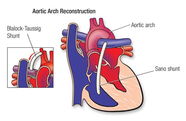 Diagrama del arco aórtico