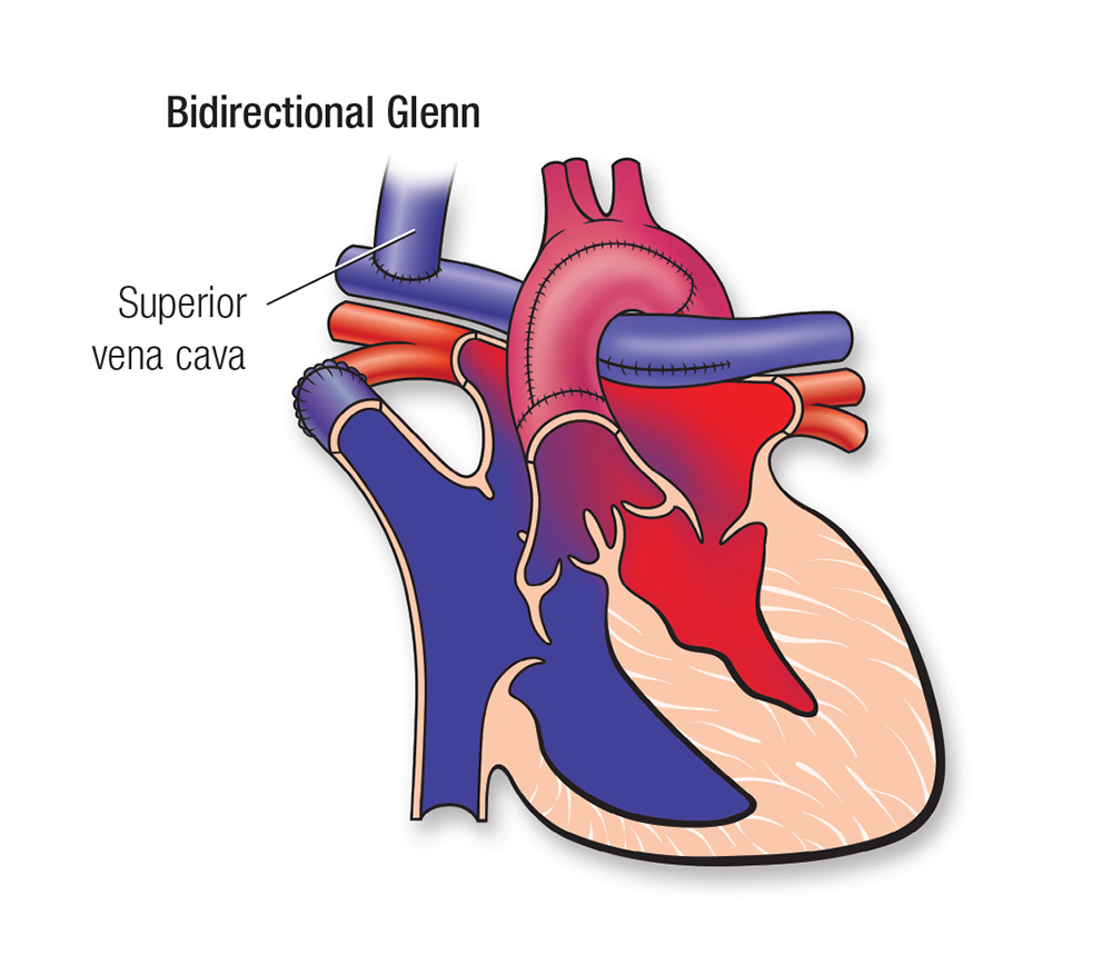 A graphic that shows the results of a bidirectional glenn operation.