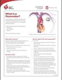 What is a pacemaker Answers by Heart sheet