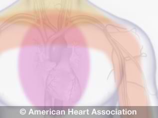 Angina (Chest Pain) | American Heart Association