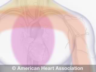 Back Pain: Could it be Your Heart?: Phoenix Heart: Cardiologists