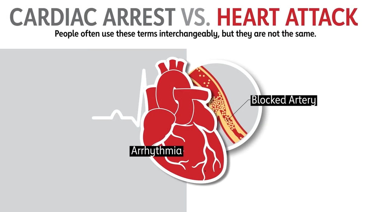 Cardiac arrest vs Heart Attack video