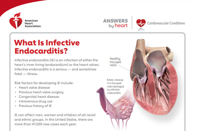 Heart Valves And Infective Endocarditis American Heart Association