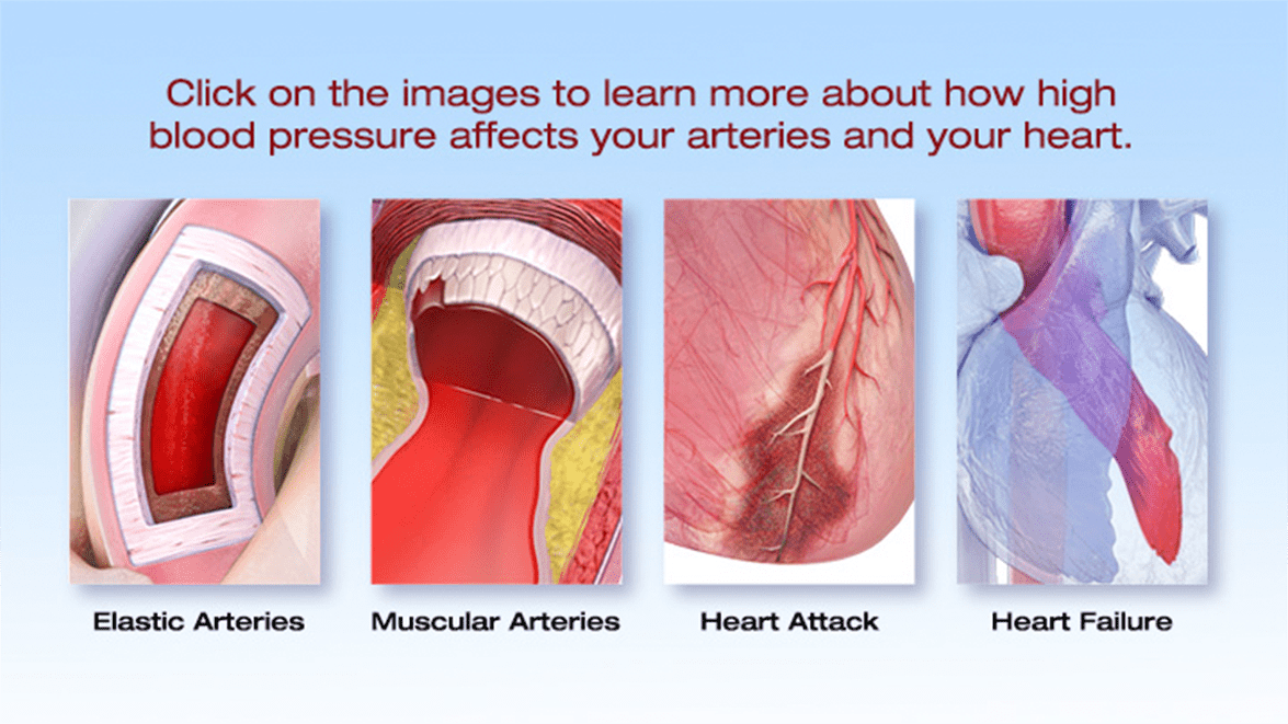 what causes high blood pressure in dogs