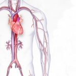 High blood pressure illustration