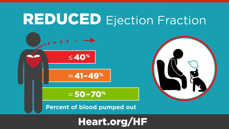 begaan monster ik ontbijt Ejection Fraction Heart Failure Measurement | American Heart Association