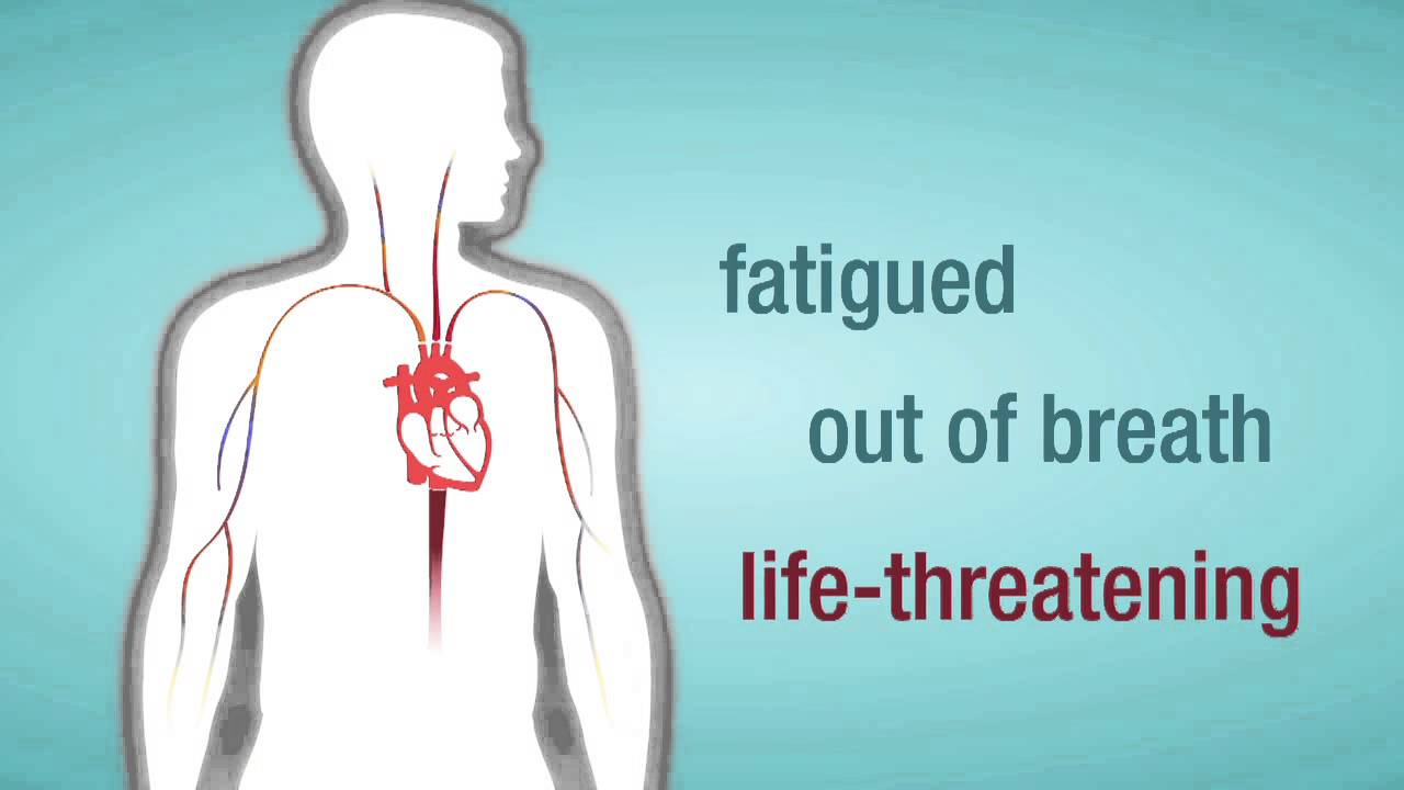 Problem: Mitral Valve Regurgitation | American Heart Association Problem: Mitral Valve Regurgitation | American Heart Association