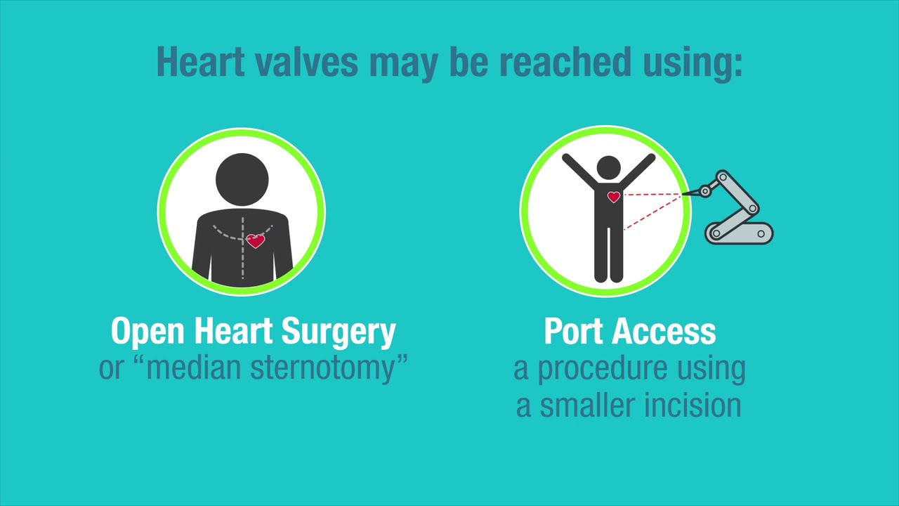 Heart Valve Treatment Options video screenshot