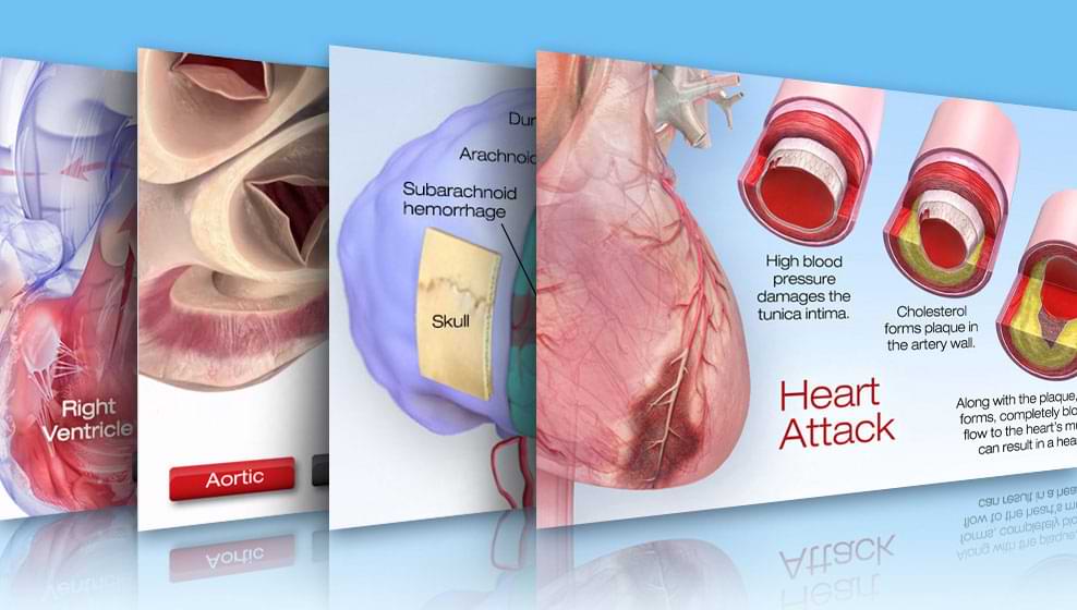 Interactive Cardiovascular Library Thumbnail image