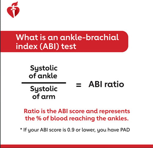 What is an ankle-brachial index test?