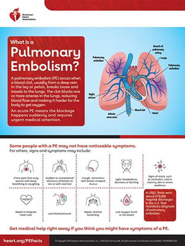 What is Pulmonary Embolism?