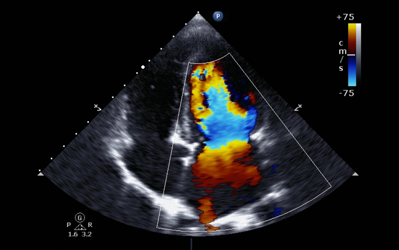 Echocardiogram image.