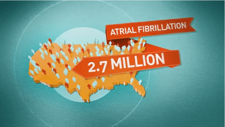 AFib information
