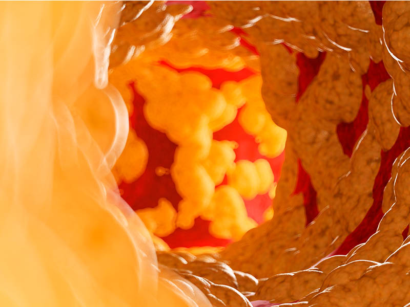 new research cholesterol