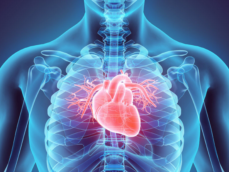 Silent heart attacks all too common, and often overlooked | American Heart  Association