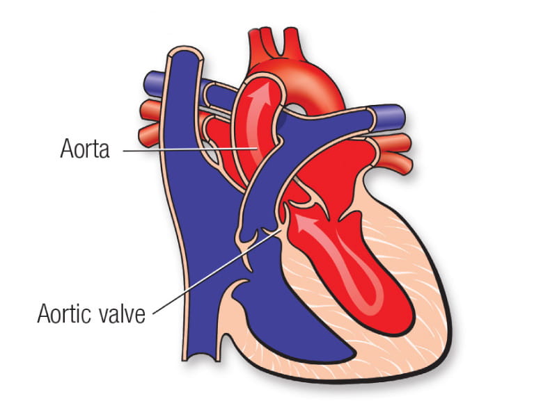 a graphic illustration of the heart showing the aorta and the aortic valve