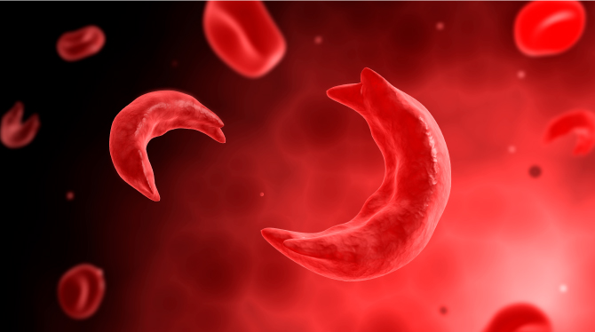 Sickle cell red blood cells