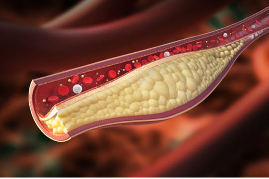 close-up illustration of cholesterol in artery