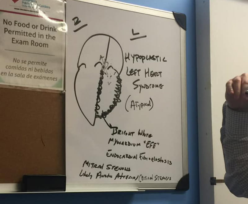 The drawing the pediatric cardiologist sketched on a dry erase board to explain hypoplastic left heart syndrome. (Photo courtesy of Stephanie Lewis)