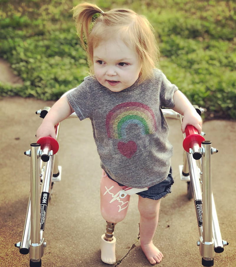 Halle's amputation hasn't held her back from being a spunky, energetic toddler. (Photo courtesy of Autumn Spivey)