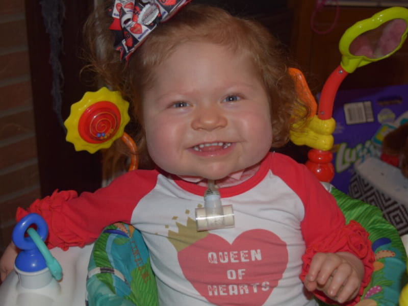 Even after four open-heart surgeries and a transplant, Tessa Agnoli is a happy, smiling two-year-old. (Photo courtesy of Courtney Agnoli)