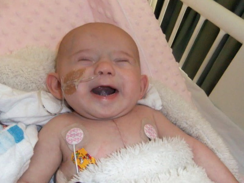 Maggie Maine, who was born with heart and brain defects. (Photo courtesy of the Maine family.)