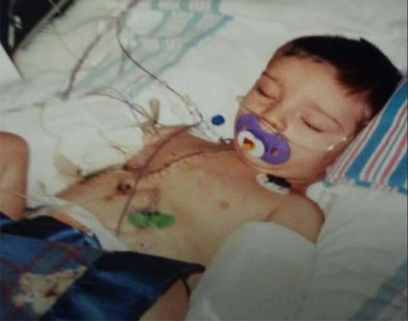 Zayne McCall as a young child recovering in the hospital after surgery. (Photo courtesy of Zayne McCall)