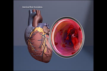 medical image of the heart