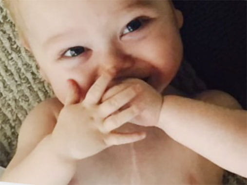 baby Finn, heart disease survivor baby Finn, heart disease survivor
