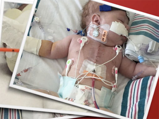 baby Finn, heart disease survivor in the NICU