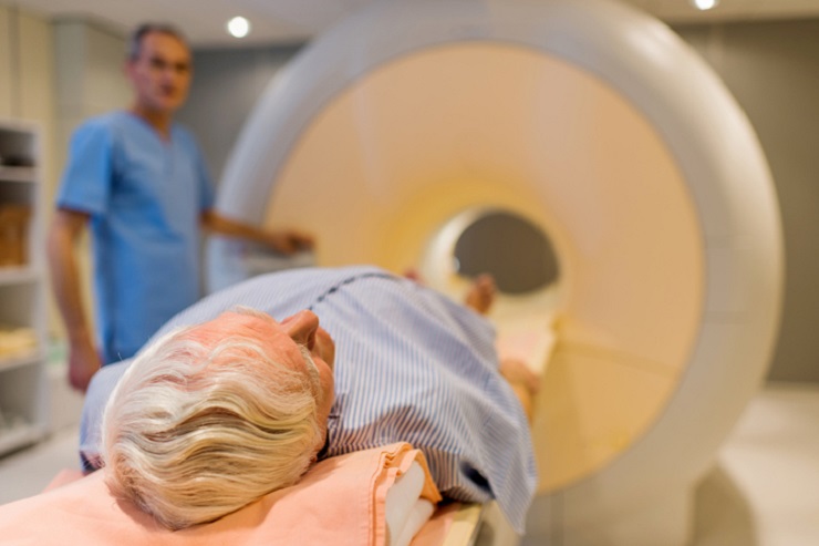 cryptogenic stroke