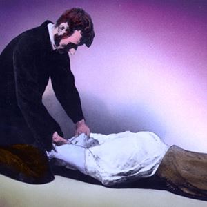 Silvester method History of CPR | American Heart Association CPR & First Aid