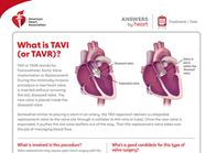 Life Expectancy After Aortic Valve Replacement Juan Marks