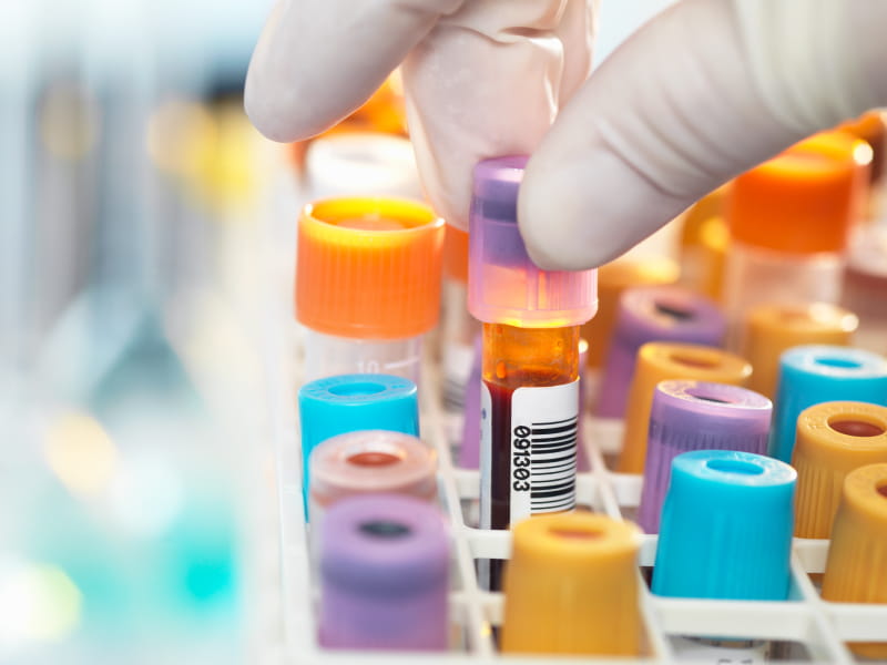 What's blood type got to do with clot risk? | American Heart Association