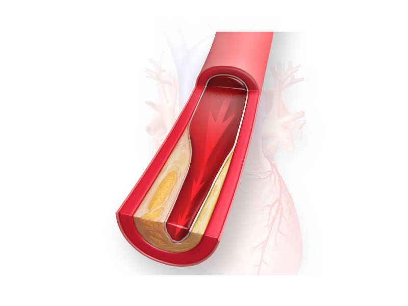 Making sense of cholesterol – the good, the bad and the dietary | American  Heart Association