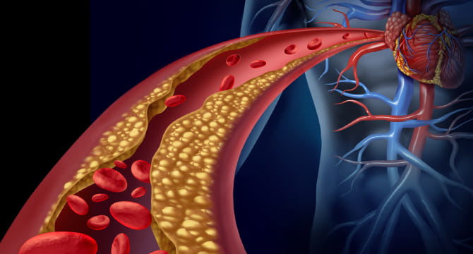 south asian diet and heart disease