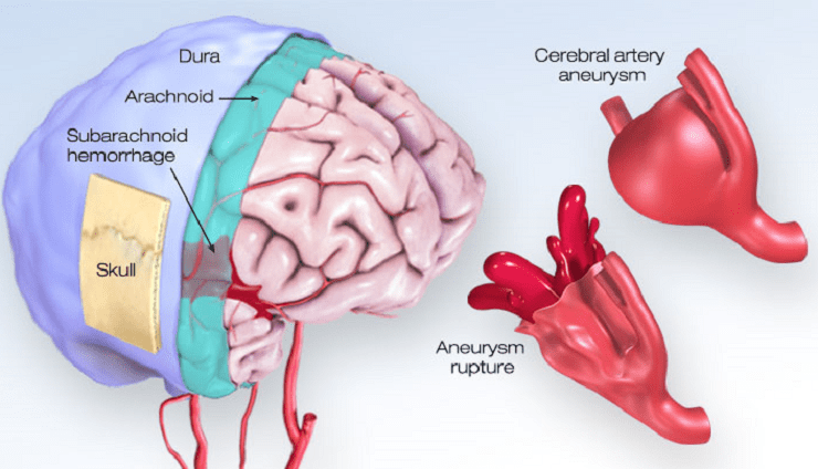 Carotid pulse location