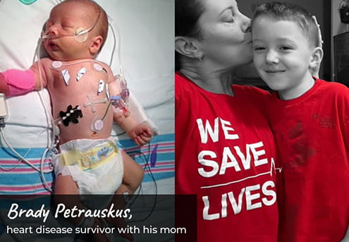 Images of Brady, Heart Survivor