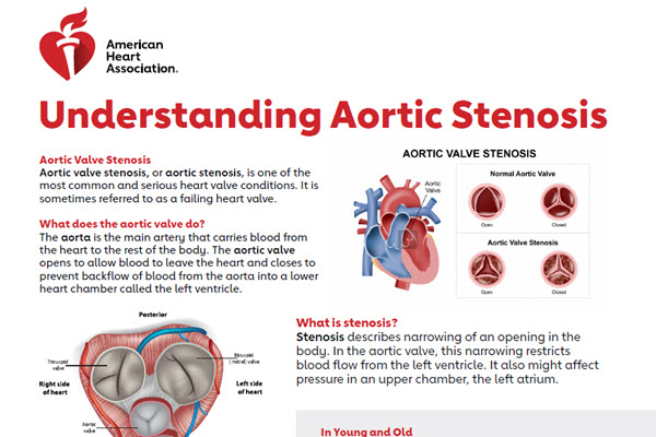 Understanding aortic stenosis overview
