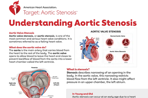 Understanding aortic stenosis overview