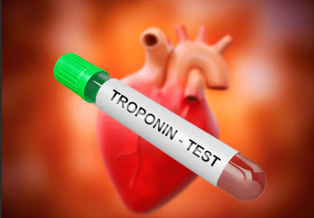troponin test